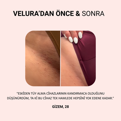 Velura 2.0 Bikini Tıraş Makinası
