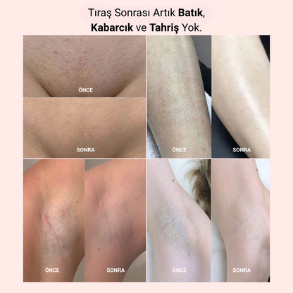 Velura 2.0 Bikini Tıraş Makinası