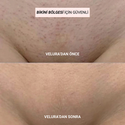 Velura 2.0 Bikini Tıraş Makinası