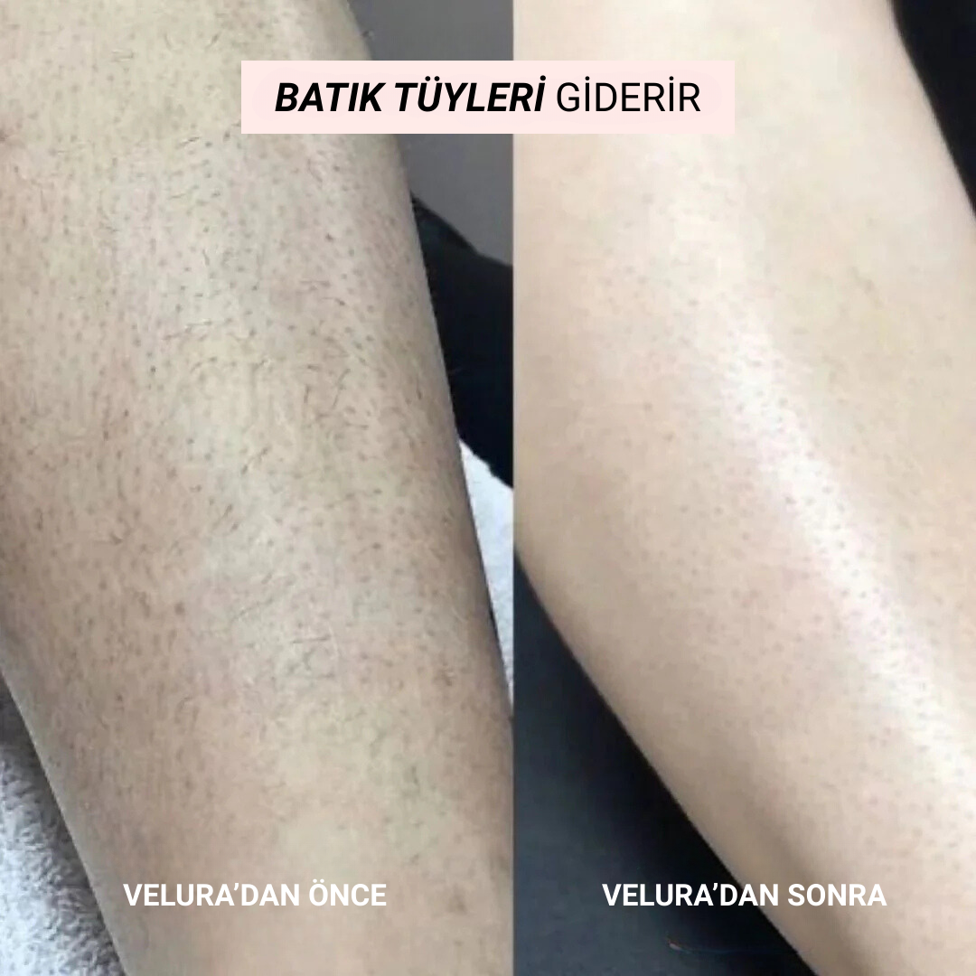 Velura 2.0 Bikini Tıraş Makinası