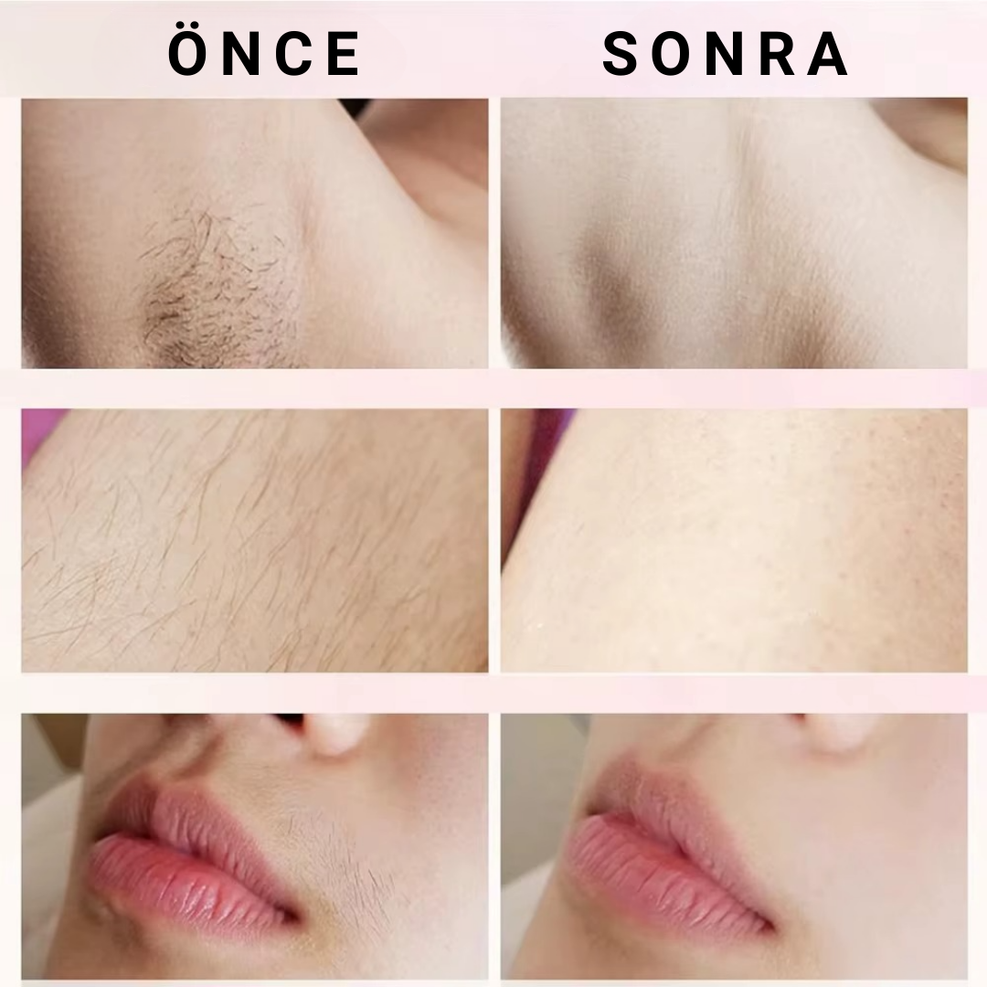 Velura 2.0 Bikini Tıraş Makinası